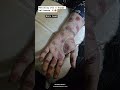 Burn hand Makeup #halloween2025#burnhand#trendingshorts#ghost#horrorstories#viral#1millionview#short