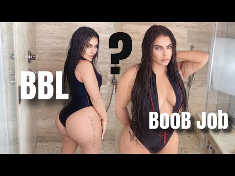BBL & Boob Job: Is It Truly Worth It? My Honest Review
