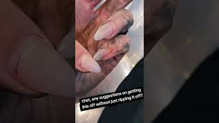 Broken nail!