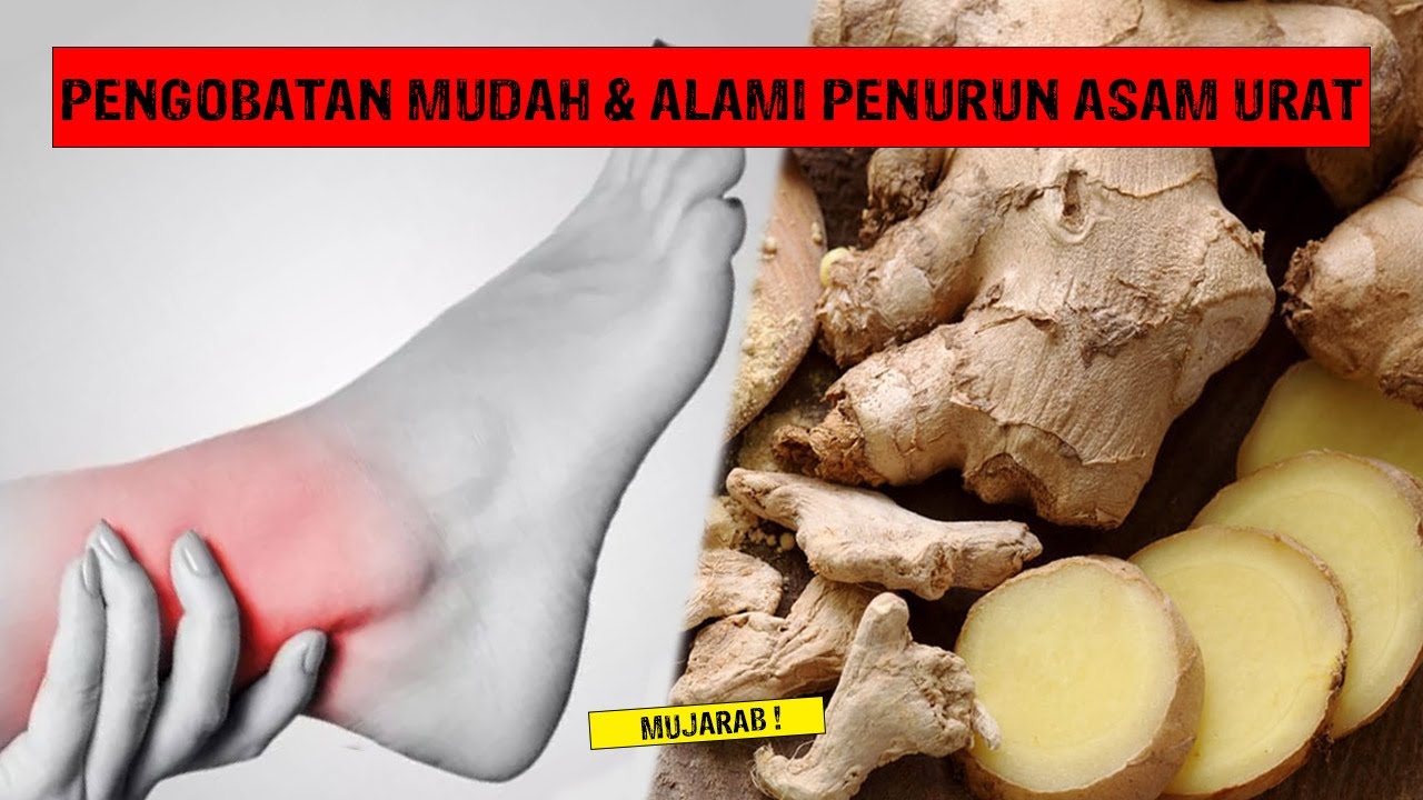 PUNYA ASAM URAT ?? PENGOBATAN MUDAH & ALAMI INI EFEKTIF UNTUK