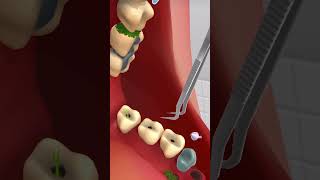 Teeth treatment with animation animation animi  satisfying