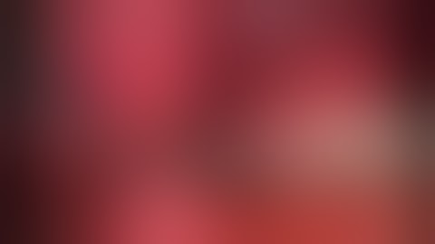 A Complicated Case of Mirrizi Syndrome