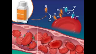 Iptacopan for Paroxysmal Nocturnal Hemoglobinuria | NEJM