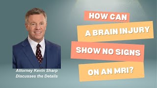 How Can A Mild Brain Injury Show No Signs On An MRI?