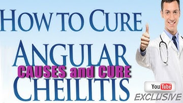 What Causes Angular Cheilitis Embarrassment & Pain Use This Angular Cheilitis Cure