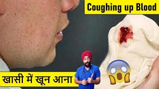 खस म खन मतलब कय Blood In Cough Sputum Reasons Dr.education