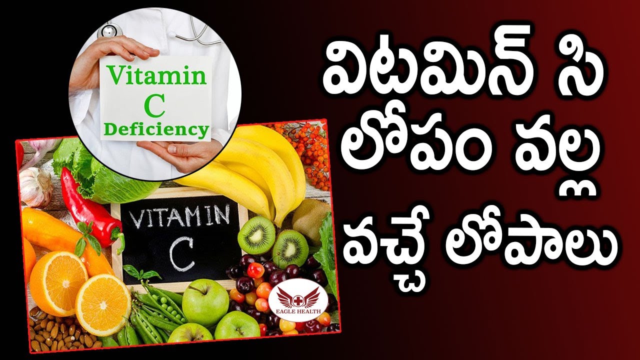 Vitamin C Deficiency Telugu I విటమిన్ సి లోపం I Vitamin C deficiency