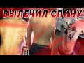 ГНИЛАЯ СПИНА. Как я вылечил кожу и комплексы :)