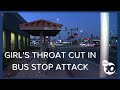 Teen girl&#39;s throat cut in unprovoked attack at Chula Vista bus stop