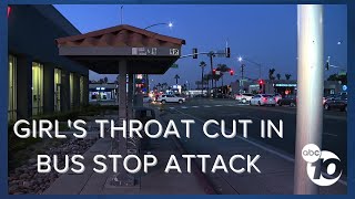 Teen girl&#39;s throat cut in unprovoked attack at Chula Vista bus stop