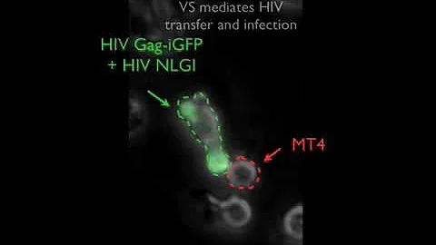 Time Lapse Images of  T Cell Synapse Resulting in Infection over Several Days