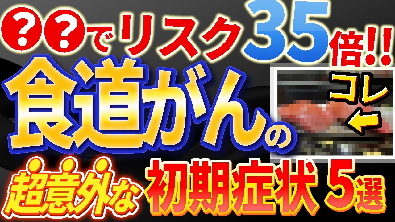 【超大切!!】絶対見逃してはいけない食道がんの初期症状やリスクについて医師が解説します。