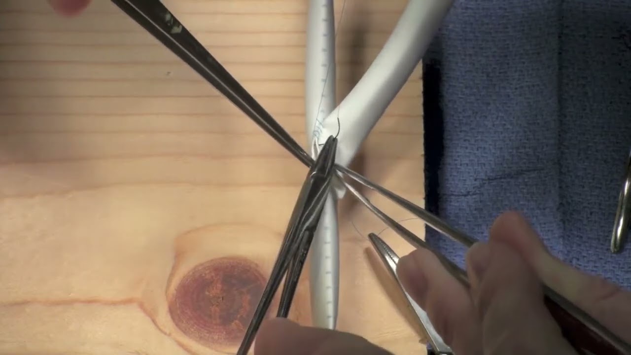 End-to-Side Vascular Anastomosis