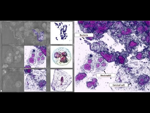 Pap-test results with 3D microscope