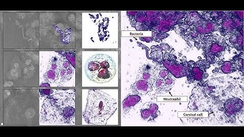 Pap-test results with 3D microscope