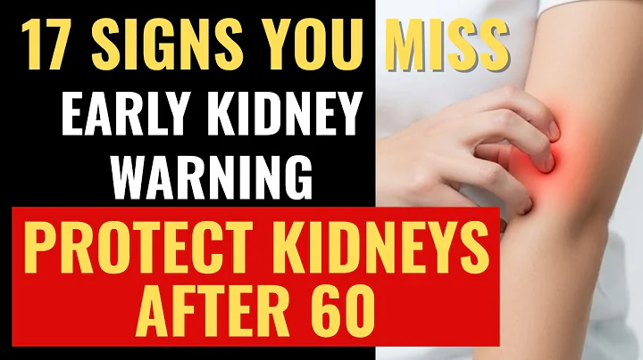 17 Warning Signs of KIDNEY DISEASE You Can Spot Early: Doctor Reveals
