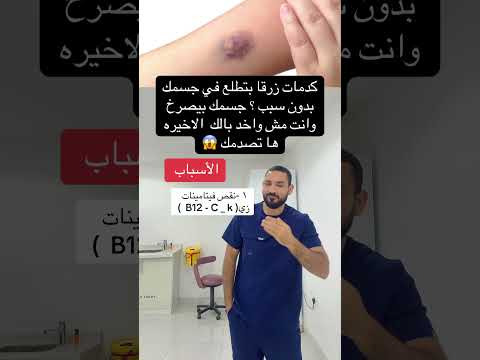 كدمات زرقا بتطلع في جسمك بدون سبب جسمك بيصرخ وانت مش واخد بالك اكسبلور التهاب ترند مرضالسكري
