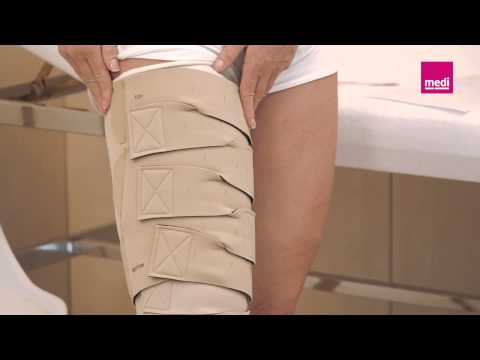 CIRCAID REDUCTION KIT UPPER LEG - Adaptive Direct