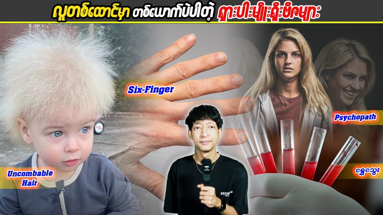 လူတစ်ထောင်မှာတစ်ယောက်ပဲပါတဲ့ ရှားပါးမျိုးရိုးဗီဇများ#LinnthitUniverse #Linnthit #SportsBox #Kb