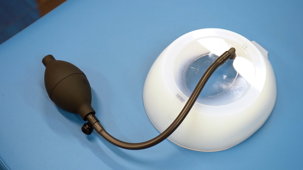 Vacuum Bell Non Surgical Correction of Pectus Excavatum YouTube