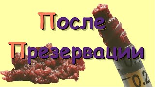 После Презервации