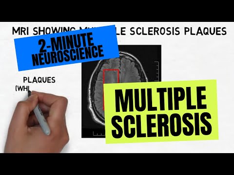 Video: Doodt multiple sclerose u?