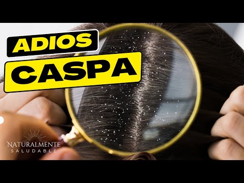 Remedios caseros para la caspa con limon