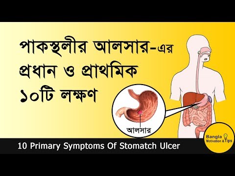 গ্যাস্ট্রিক আলসারের প্রাথমিক ও প্রধান ১০টি লক্ষণ | 10 Primary Symptoms Of Ulcer