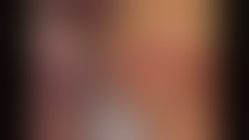 Laparoscopic resection of gastric GIST by Dr Hitesh Chavda, Ahmedabad