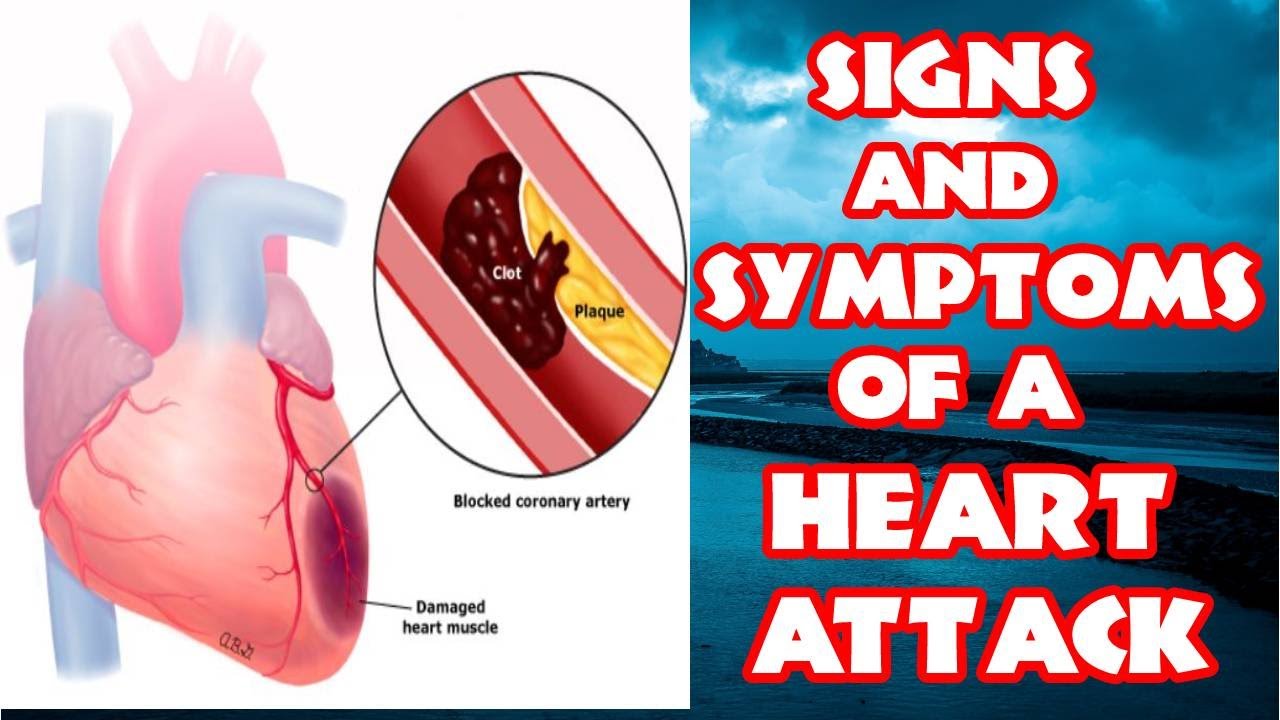 How To Tell If You Are Having A Heart Attack Heart