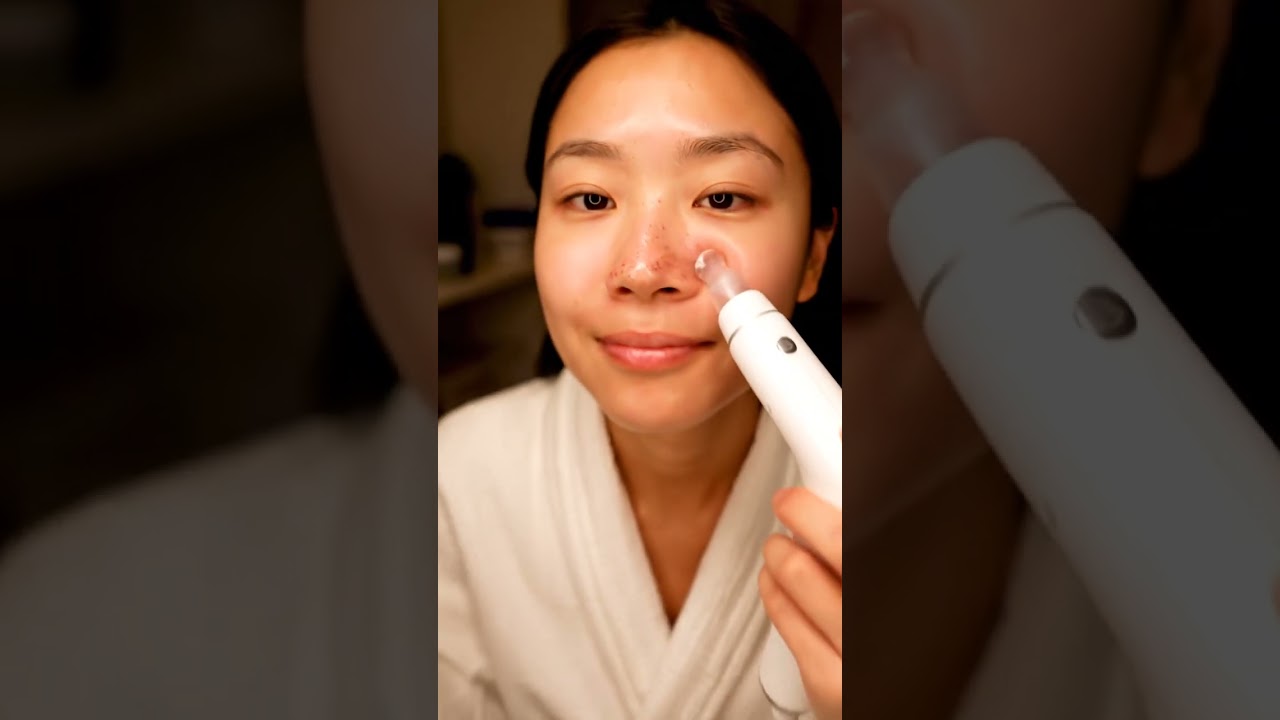 The Most Relaxing Blackhead Removal Ever