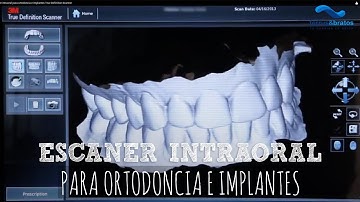 Escaner intraoral para ortodoncia e implantes True Definition Scanner