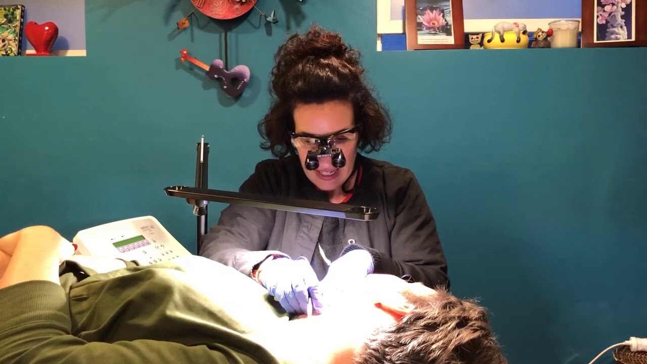 Facial Electrolysis for Transgender and nonconforming people