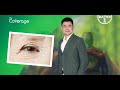 เตือนภัย! โรคจอตา nAMD-DME ทำตาบอดถาวร | คัดกรองปีละครั้งช่วยชีวิต