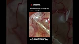 🚨 ¡TUS OJOS NO MIENTEN! LA ÚNICA VENTANA REAL A TUS VENAS 👁️🩸