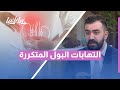 تحذير طبي: متى تكون التهابات البول خطرًا على صحتك؟