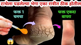 एकदा हळद वापरा टाचेला पडलेल्या भेगा रात्रीत ठीक होतील 😱 Marathi kitchen / kitchen tips / recipe screenshot 5