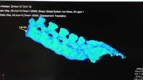 FEM(Finite Element Method) Simulation of Lumbar Spine