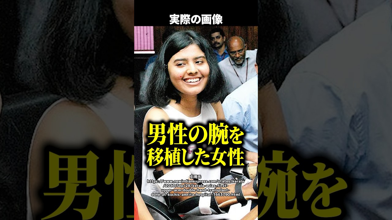 【実話】両腕を失った女子大生→移植されたのは『男性の腕』！？体に起きた〇〇な変化に医師も驚愕した... #shorts