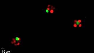 Breast Epithelial Cells Aggregating And Condensing Into A Microtissue In Culture