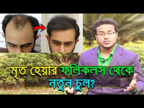 ভিডিও: কালো চুল গজানোর 3 টি উপায়