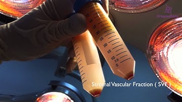 Progenikine Kit for Adipose Derived Stem Cell Procedures