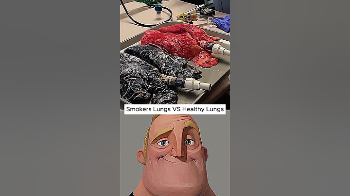 This Is What Smoking Does to Your Lungs… #Shorts