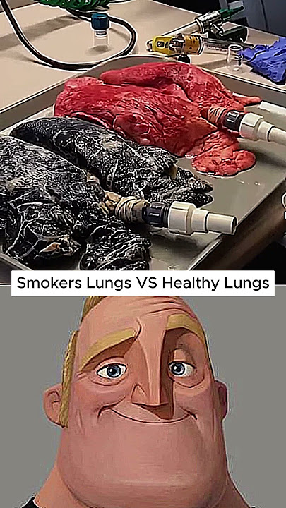 This Is What Smoking Does to Your Lungs… #Shorts
