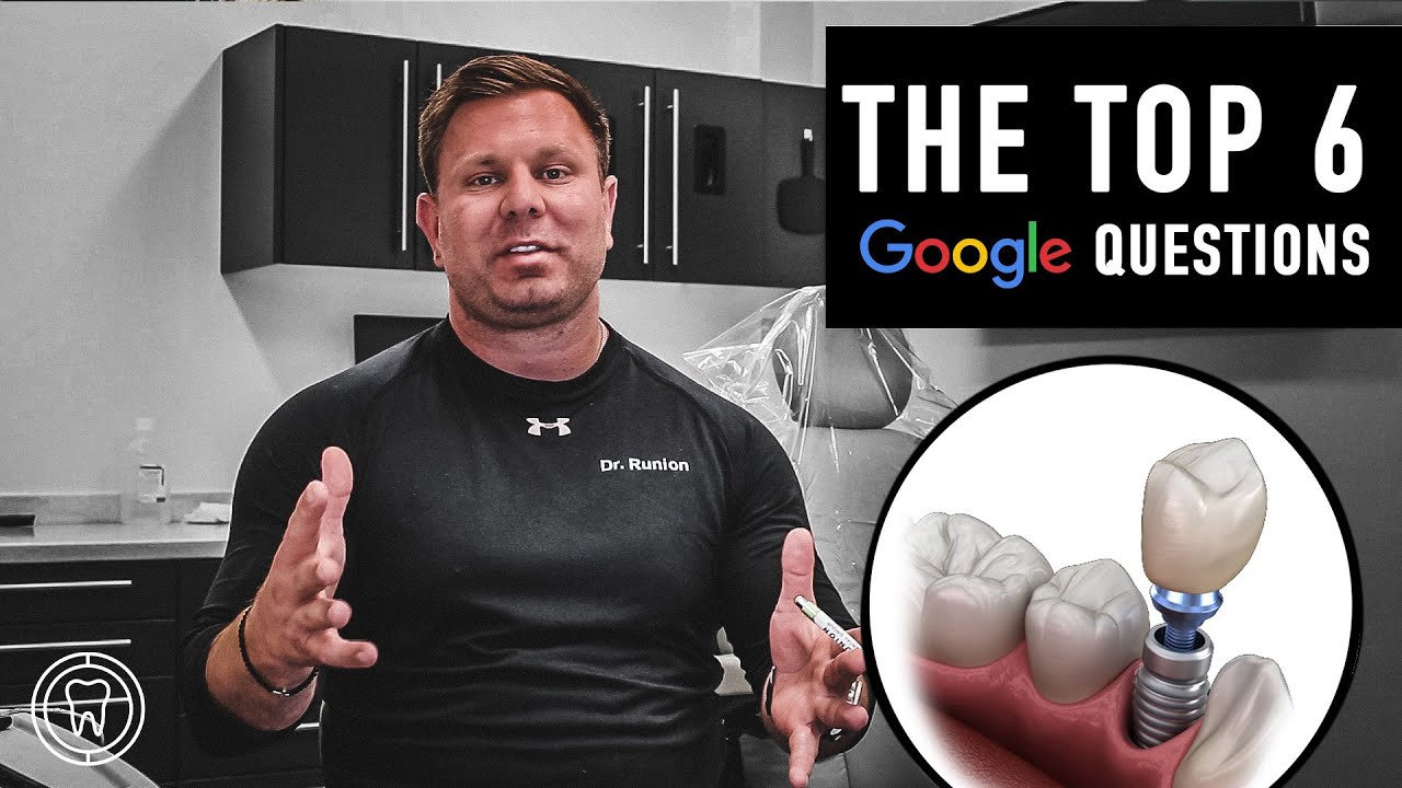 Top 6 Dental Implant Questions YouTube