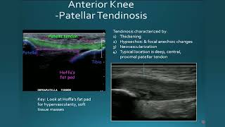 Ultrasound Evaluation of Knee Pathology-SAMPLE