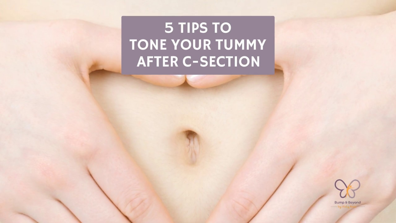 5 Tips To Tone Your Tummy After C Section YouTube