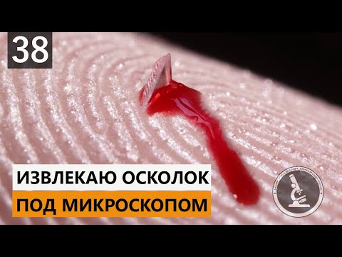 ЖЕСТЬ!!! ИЗВЛЕКАЮ СТЕКЛО ИЗ ПАЛЬЦА / GESTURE!!! I REMOVE GLASS FROM THE FINGER