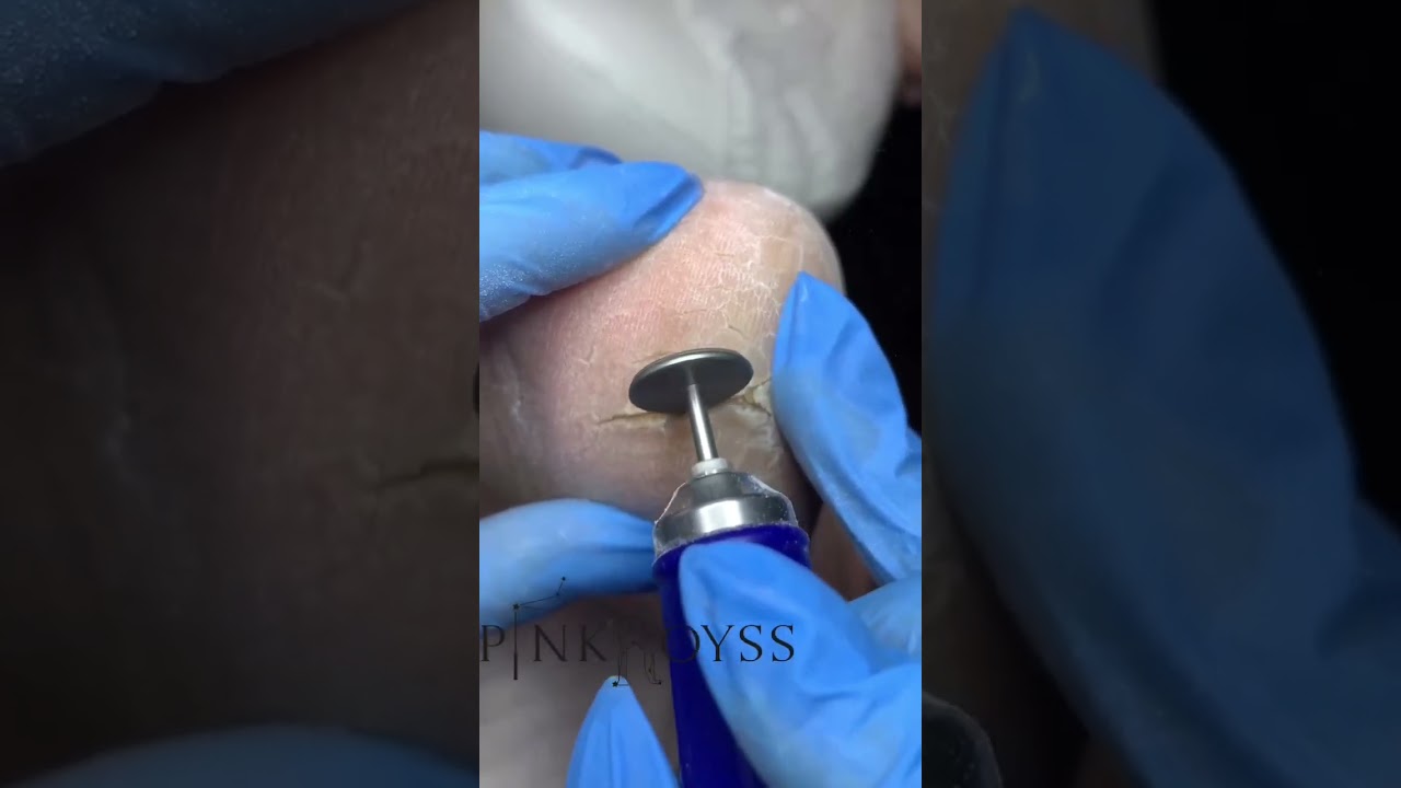 Крем для педикюра #крем #педикюр #аппаратныйпедикюр #трещинынапятках #ноги