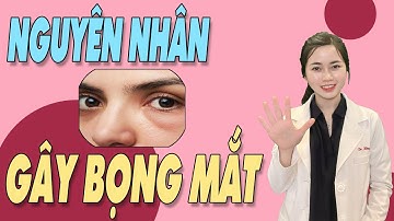 5 ĐIỀU khiến bạn dễ bị BỌNG MẮT và TRÔNG GIÀ ĐI hơn |Bs Nguyễn Ngọc